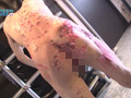 淫乱変態田舎○年よういち蝋燭責め・鞭打ちに歓喜の絶叫