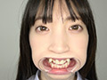 冬愛ことねの歯観察・口内・のどちんこ・舌ベロ観察！