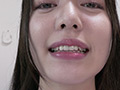 超オススメ女優 朝日しずくチャンのじっくり歯観察！