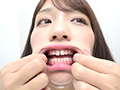 木下ひまりチャンの激レアのどちんこ歯観察しゃっくりも