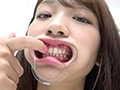 木下ひまりチャンの激レアのどちんこ歯観察しゃっくりも