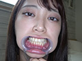 加賀美さらチャンの口内・歯観察＆電マ当て！