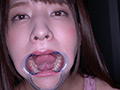 激カワ女優 あべみかこチャンの歯・のどちんこ観察！
