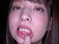 激カワ女優 あべみかこチャンの歯・のどちんこ観察！