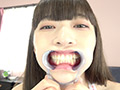 激レア！歯・口内観察 楠美める