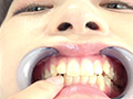 激レア！歯・口内観察 楠美める