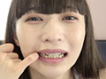 激レア！歯・口内観察 楠美める