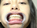 Emilyチャンの歯・唾・口内・のどちんこを観察