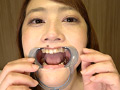 有村麻衣チャンののどちんこ・舌ベロ・歯・口内観察