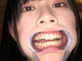 エマちゃんの歯・口内・舌ベロを観察してみた