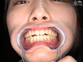 江澄ゆゆチャンの口腔・のどちんこ・舌ベロ観察プレイ