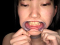 【歯・口腔】ドM女子の口内・歯・のどちんこ観察★