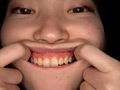 【歯・口腔】ドM女子の口内・歯・のどちんこ観察★