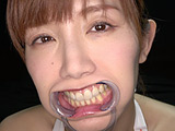 激レアな治療跡がある歯・口内・のどちんこ観察！美泉咲