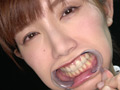 激レアな治療跡がある歯・口内・のどちんこ観察！美泉咲