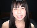 超レアな歯・口内・銀歯・のどちんこ観察！月美りょう