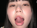 超レアな歯・口内・銀歯・のどちんこ観察！月美りょう
