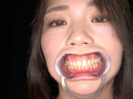 人気女優 乃木ちはるチャンの舌ベロ・歯観察