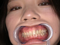 人気女優 乃木ちはるチャンの舌ベロ・歯観察