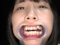 人気女優の激レアな歯・銀歯・口内・のどちんこ観察！