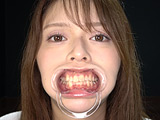 人気女優の激レアな歯・治療跡・のどちんこ観察！