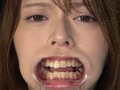 人気女優の激レアな歯・治療跡・のどちんこ観察！