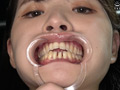 乙羽あむチャンの超レアの歯・口内・舌ベロ観察！