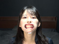 【歯・口内】綺麗なお姉さんの激レアな口内・歯観察！