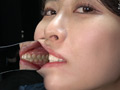 【歯・口内】綺麗なお姉さんの激レアな口内・歯観察！