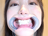 激レアの口内観察・のどちんこ観察・咀嚼！ 琥珀やや2
