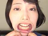 「大人気美女ゆきねさんの激レア口内・銀歯観察！」