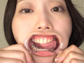 「大人気美女ゆきねさんの激レア口内・銀歯観察！」 サンプル画像3