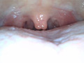 口内を激写して歯＆のどちんこ観察＆咀嚼★有加里ののか サンプル画像3