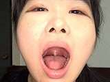 清乃みよりちゃんの初めての口内・歯・のどちんこ観察！