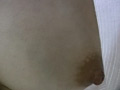 検眼しているときのあいた胸元で捉えた乳首○撮