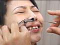 耳鼻科の女