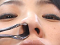 耳鼻科の女