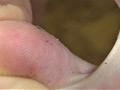 【足のにおい】粉ふきゴワゴワ