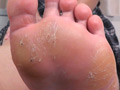 【足のにおい】豚骨臭から足蒸気