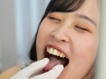 お口の中をじっくり見せてくれませんか？～ゆの～