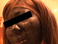 女性の顔に、油性マジックで書いてしまいました！3