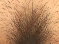 100人のまん毛 第1集