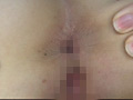 100人の尻穴 第2集