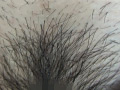 100人のまん毛 第3集