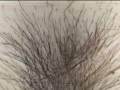 100人のまん毛 第3集