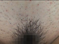 100人のまん毛 第3集