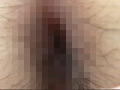 100人の尻穴 第4集