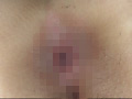100人の尻穴 第4集