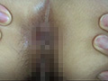 100人の尻穴 第5集