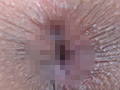 100人の尻穴 第5集